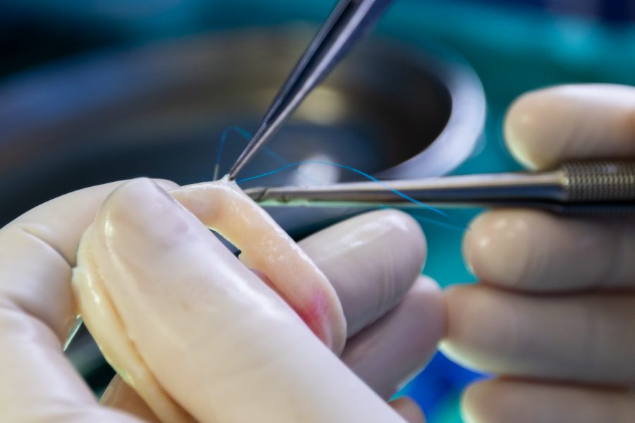 Chirurgové z VFN mají za sebou již stou transplantaci cév