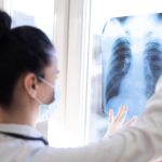 Ve VFN odstartoval pilotní projekt – Screening plicní rakoviny u kuřáků