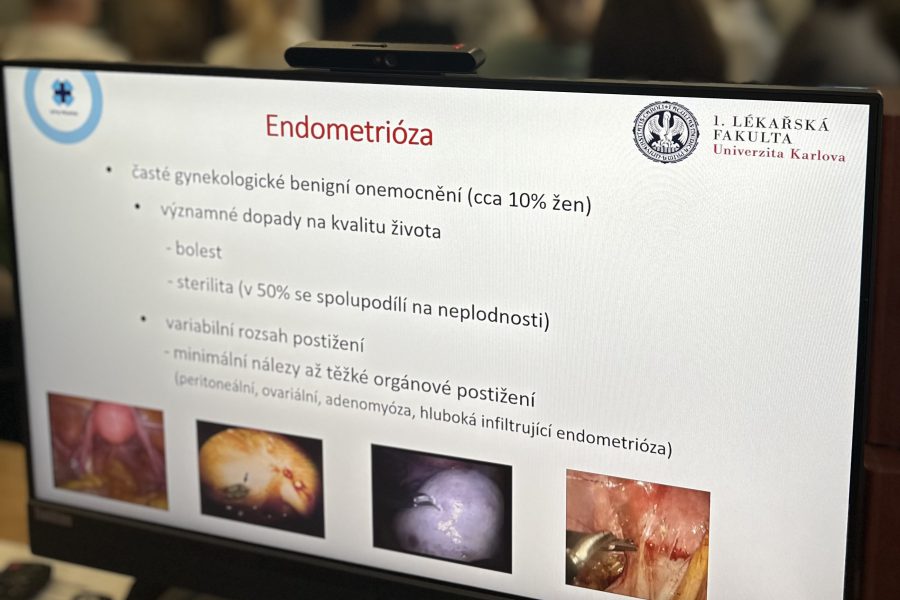 Reprodukční chirurgie ve VFN na vzestupu!