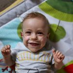 Předčasný odtok plodové vody před hranicí životaschopnosti plodu: Šance na život díky špičkové péči týmu VFN