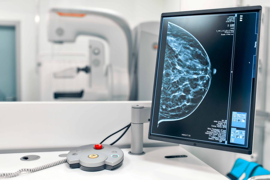 Mohou ženy chodit na preventivní mamografické vyšetření od 1. července bez žádanky? Ano, ale jen ve výjimečných případech!