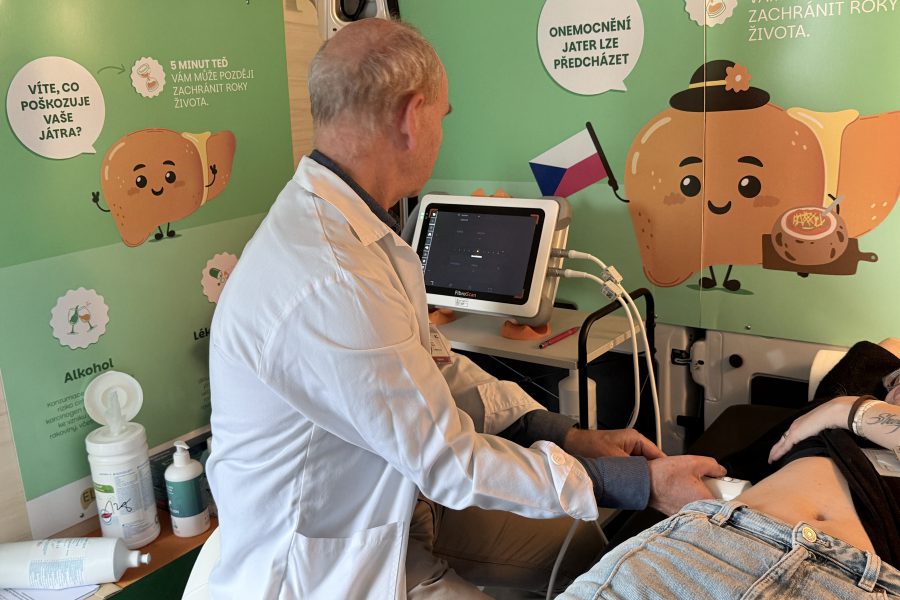 Játra mohou být nemocná, aniž bychom o tom věděli. Screening pomáhá odhalit rizika včas